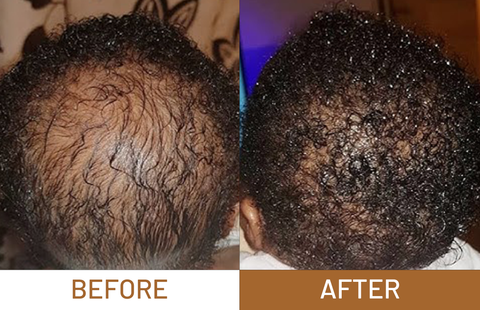 Batana Oil Pure Luxe Hair Boost Hair Growth Oil + Free Derma Roller