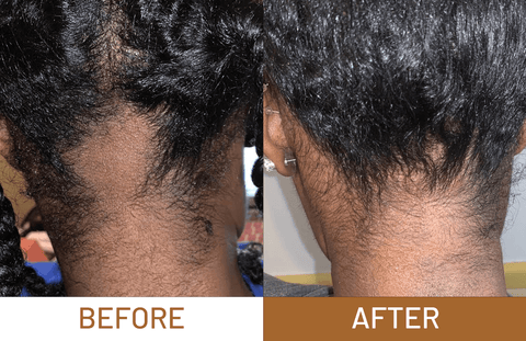Batana Oil Pure Luxe Hair Boost Hair Growth Oil + Free Derma Roller